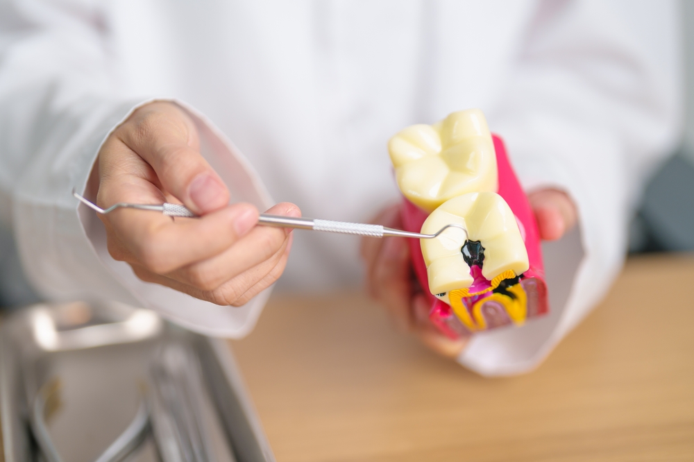 teeth-cavity-prevention