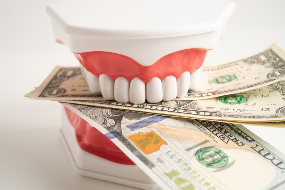 dental-insurance-cover